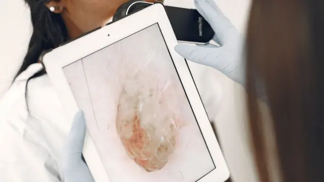 Tamamlayıcı Sağlık Sigortası Dermatolojiyi Karşılar mı? 2026 Ben Aldırma ve Cilt Rehberi