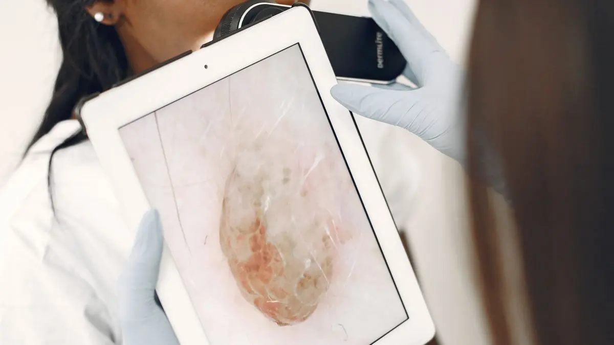 Tamamlayıcı Sağlık Sigortası Dermatolojiyi Karşılar mı? 2026 Ben Aldırma ve Cilt Rehberi